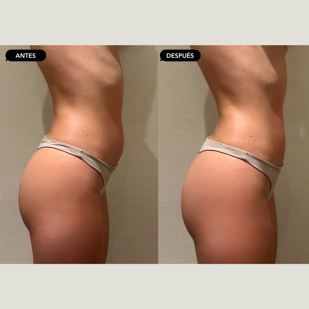 Accent Prime