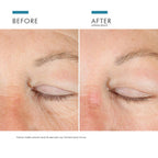 A.G.E. Eye Complex