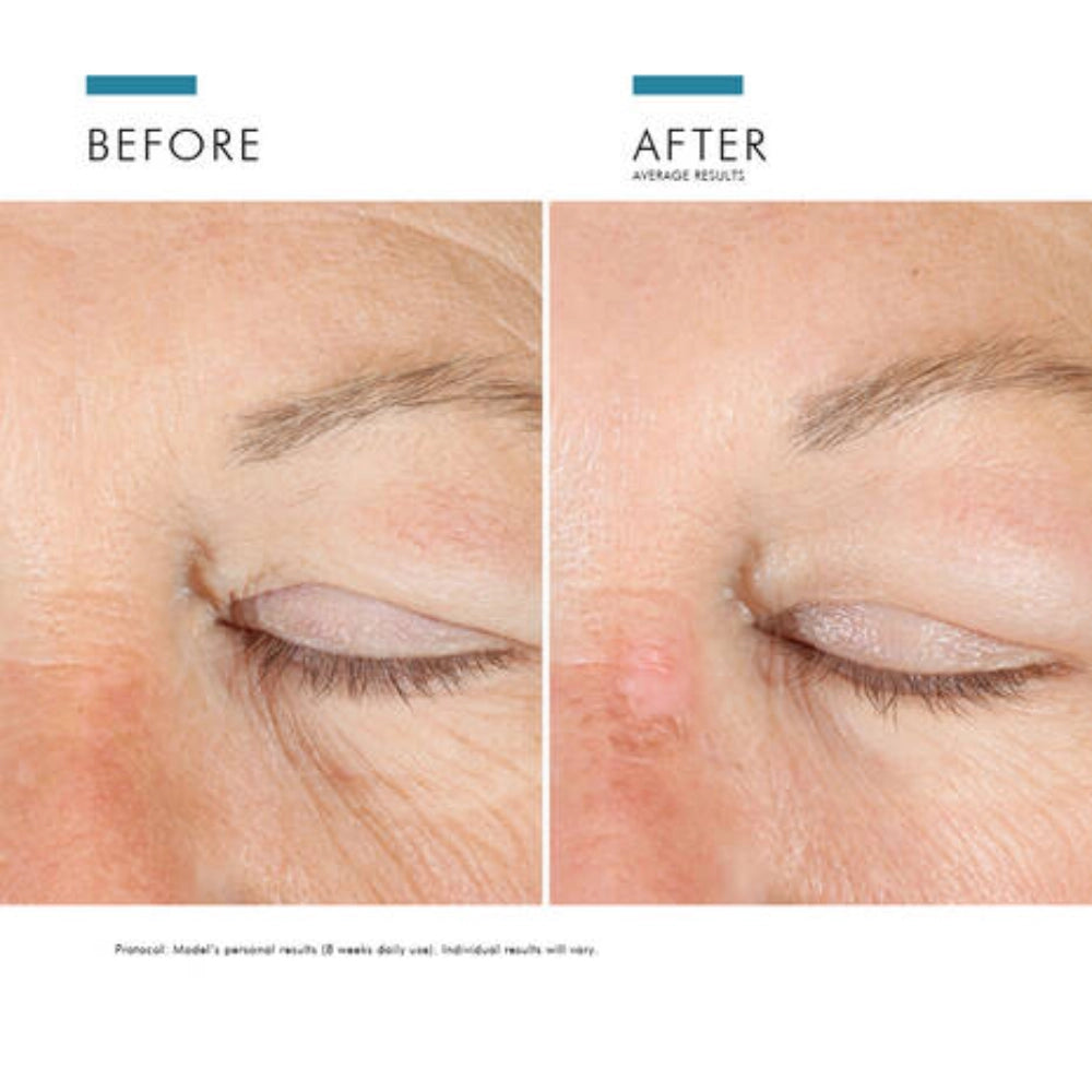 Complexe oculaire AGE
