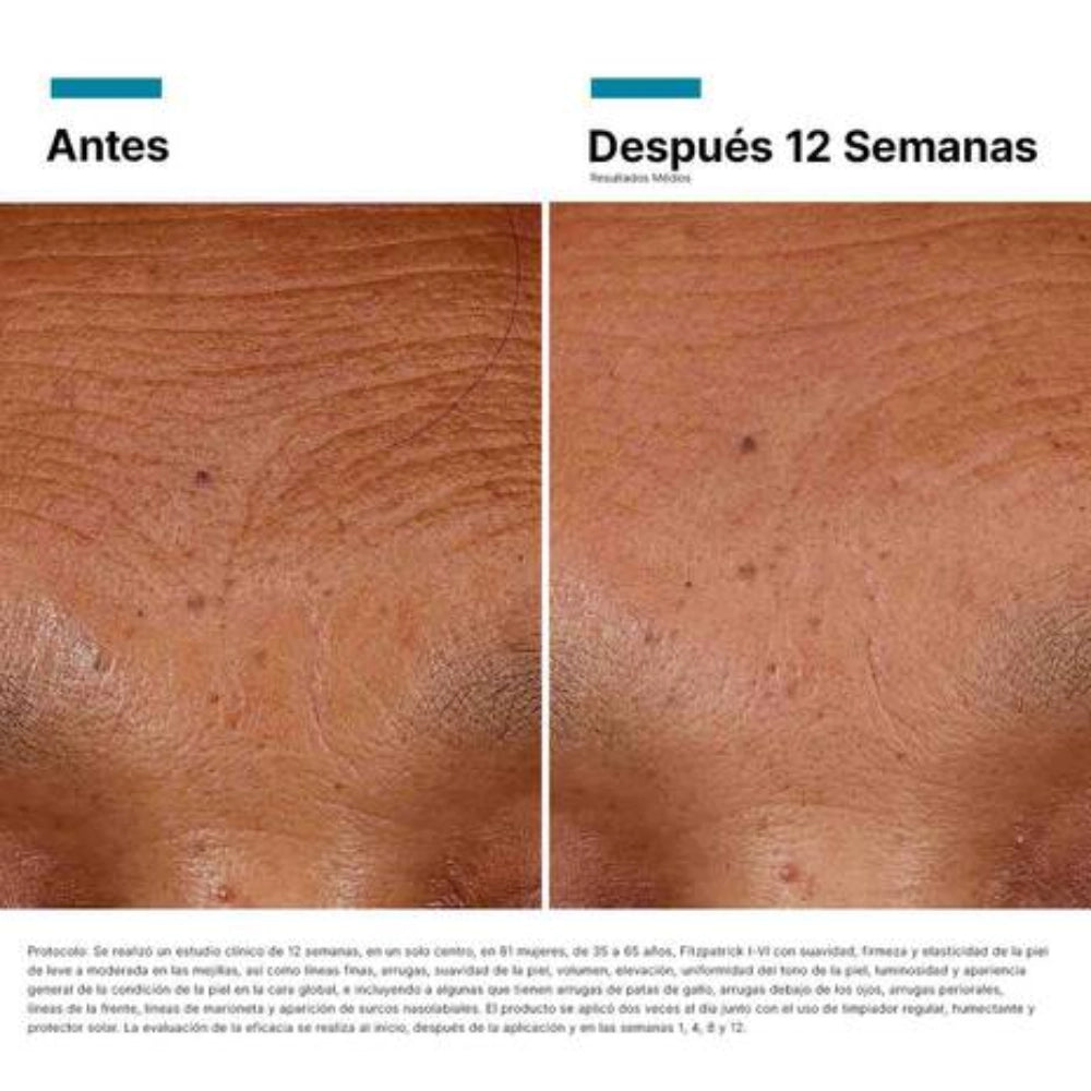 Ultra Age Interrupter Serum