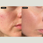 Detox facial
