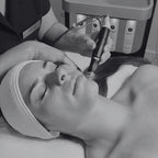 Hydrafacial Platinum