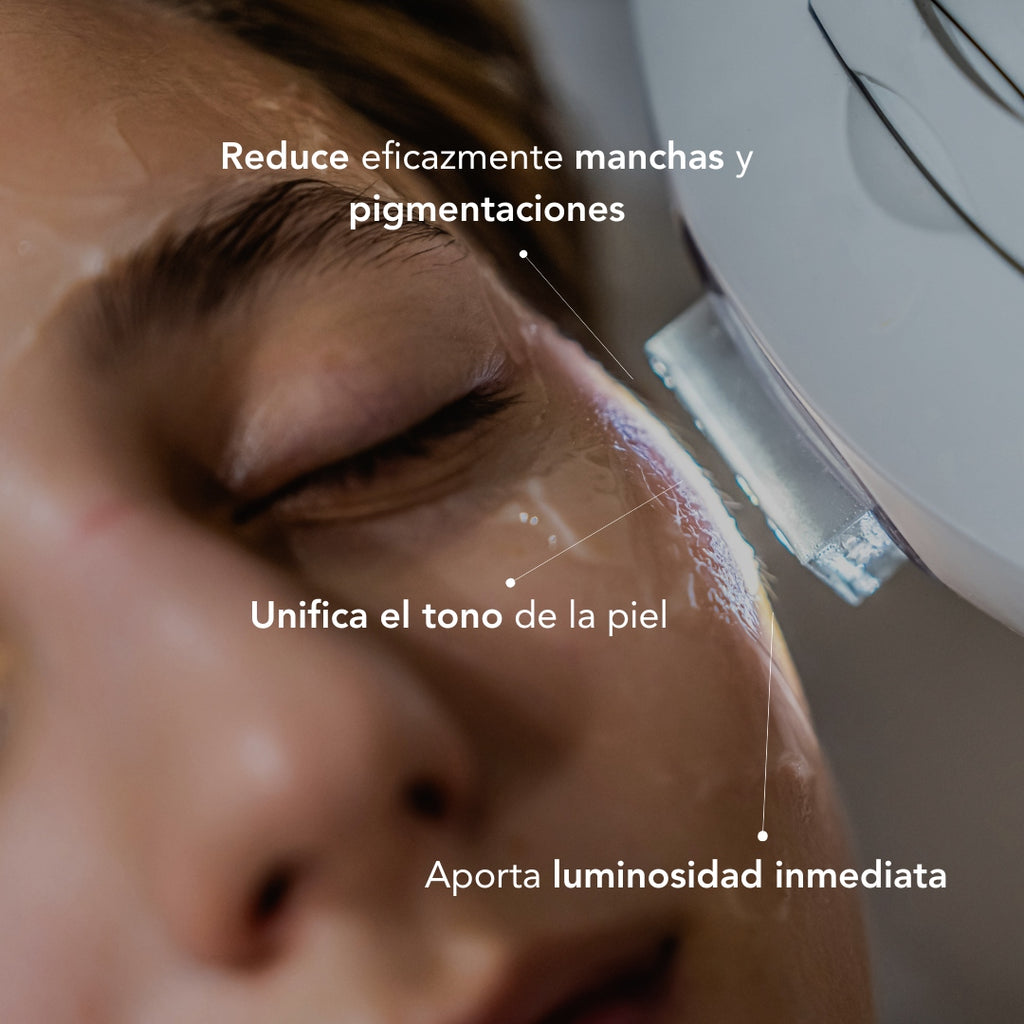 Traitement anti-imperfections par lumière pulsée intense (IPL)