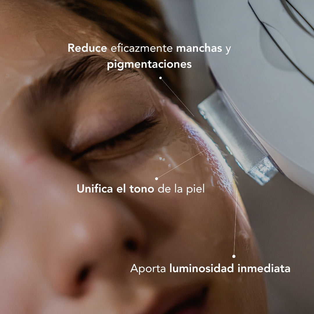 Traitement anti-imperfections par lumière pulsée intense (IPL)