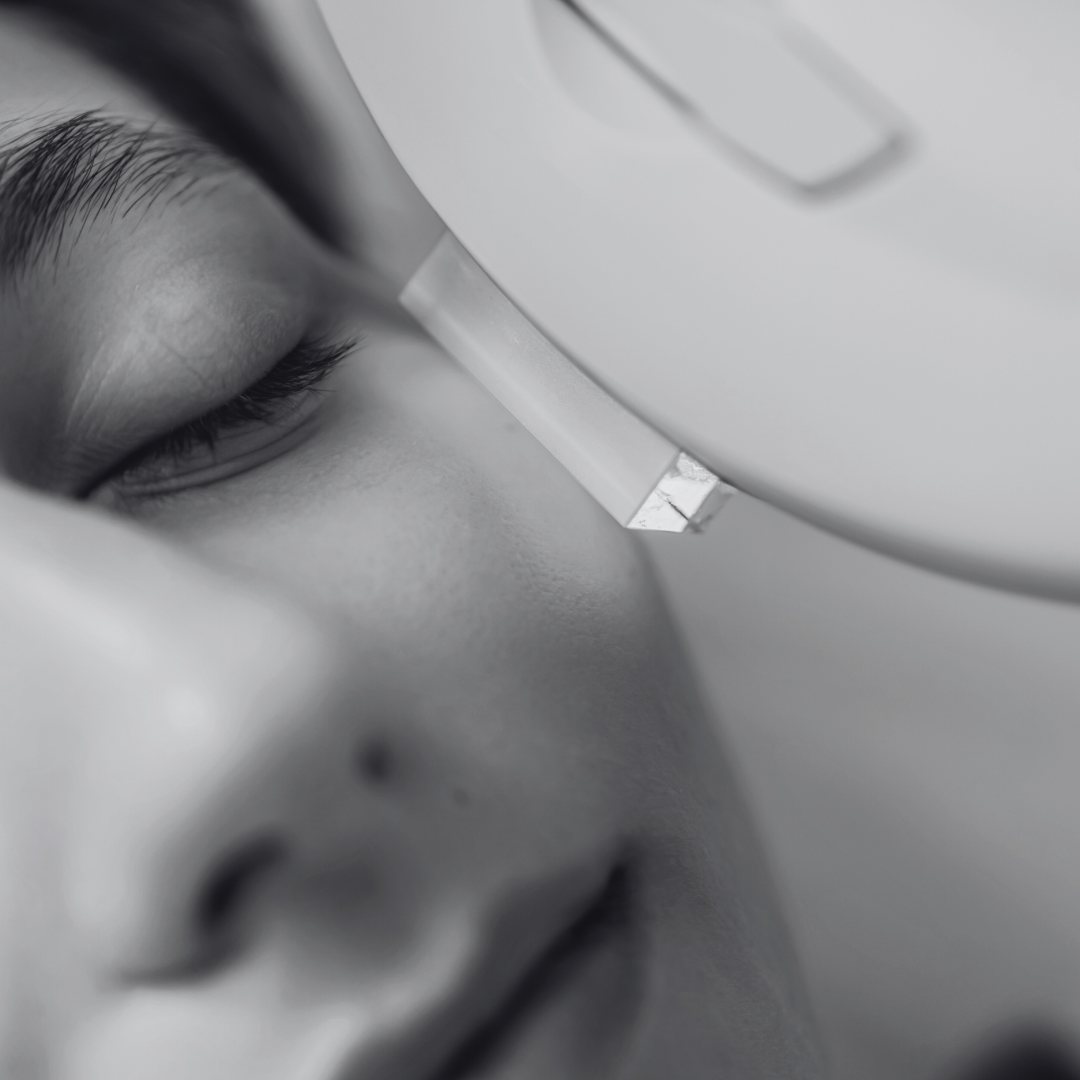 Traitement anti-imperfections par lumière pulsée intense (IPL)