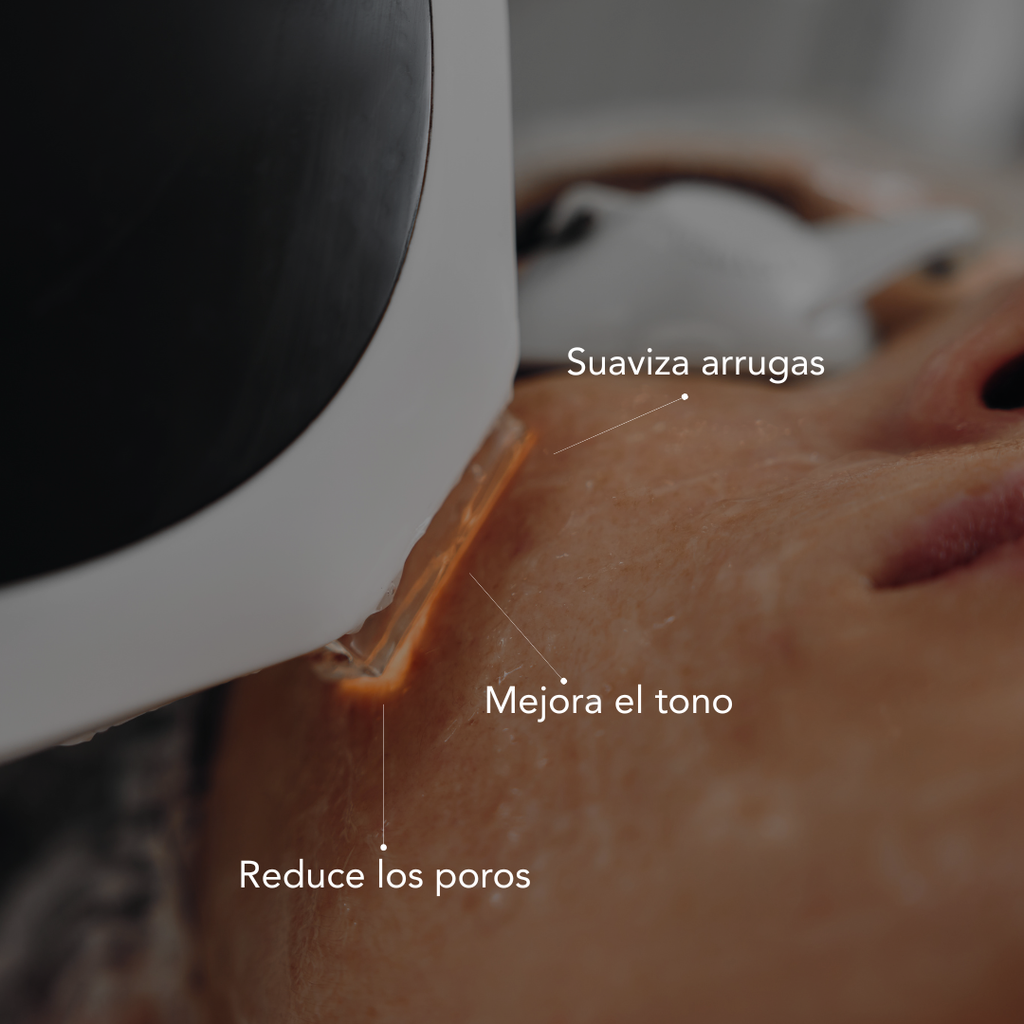 IPL Rejuvenation Treatment