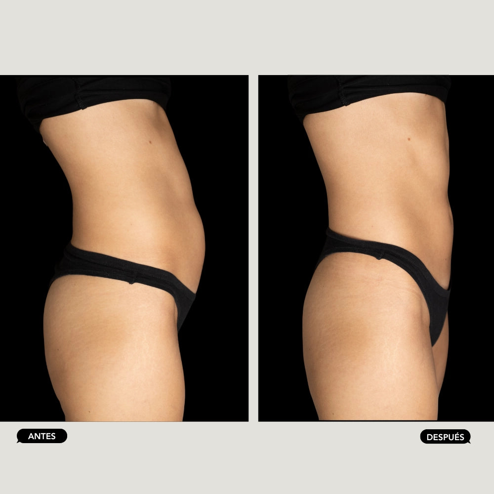 Masaje remodelante filipino