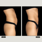 Masaje remodelante filipino