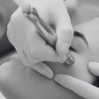 Microdermoabrasión