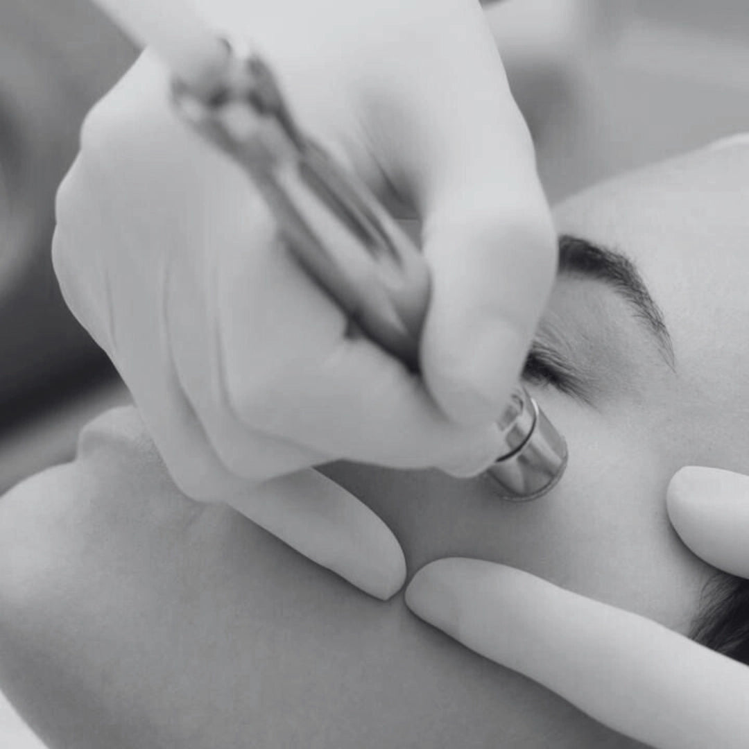 Microdermabrasion