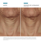 Tripeptide-R Neck Repair