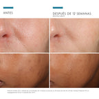 Phloretin CF serum