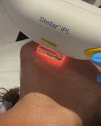 Carte cadeau anti-imperfections IPL