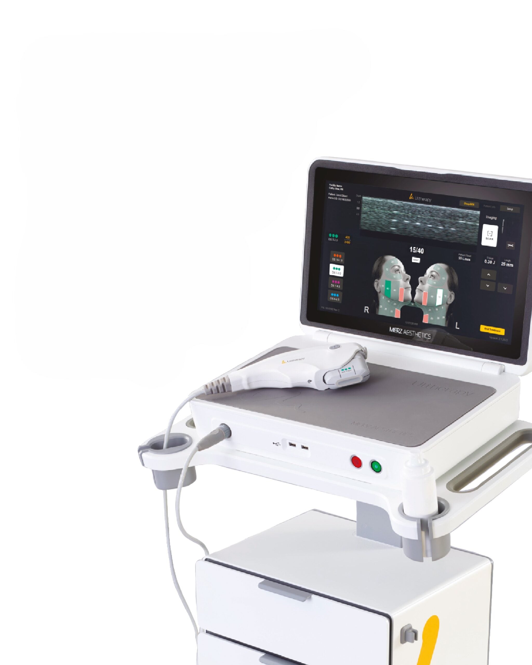 Ultherapy Prime Escote